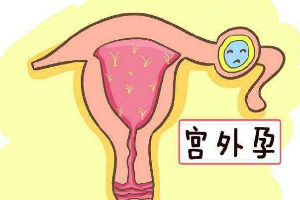 泰国试管婴儿移植囊胚儿子概率大吗