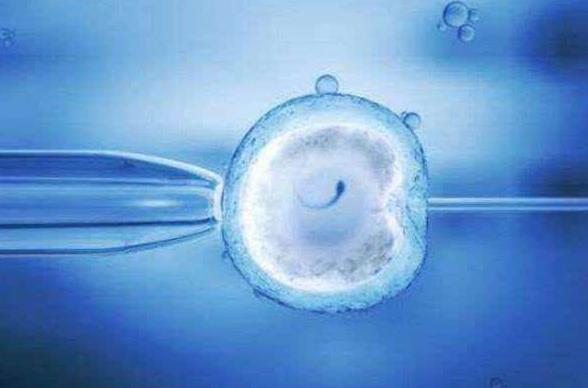 2024杭州三代试管染色体异常选儿子费用多少钱